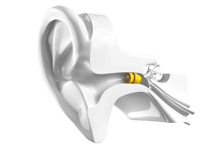 drawing of an ear with phonak lyric inserted in ear canal